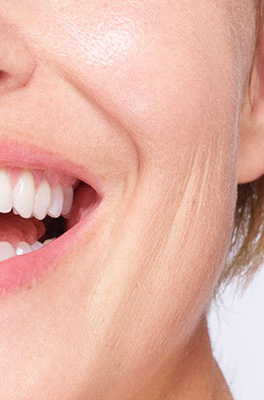 Deep wrinkles visibility