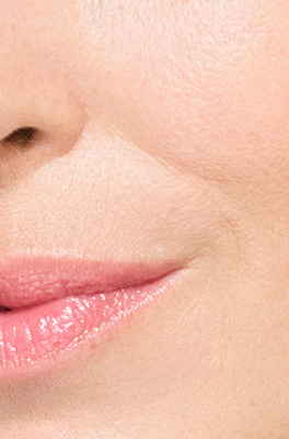 Fine lines visibility